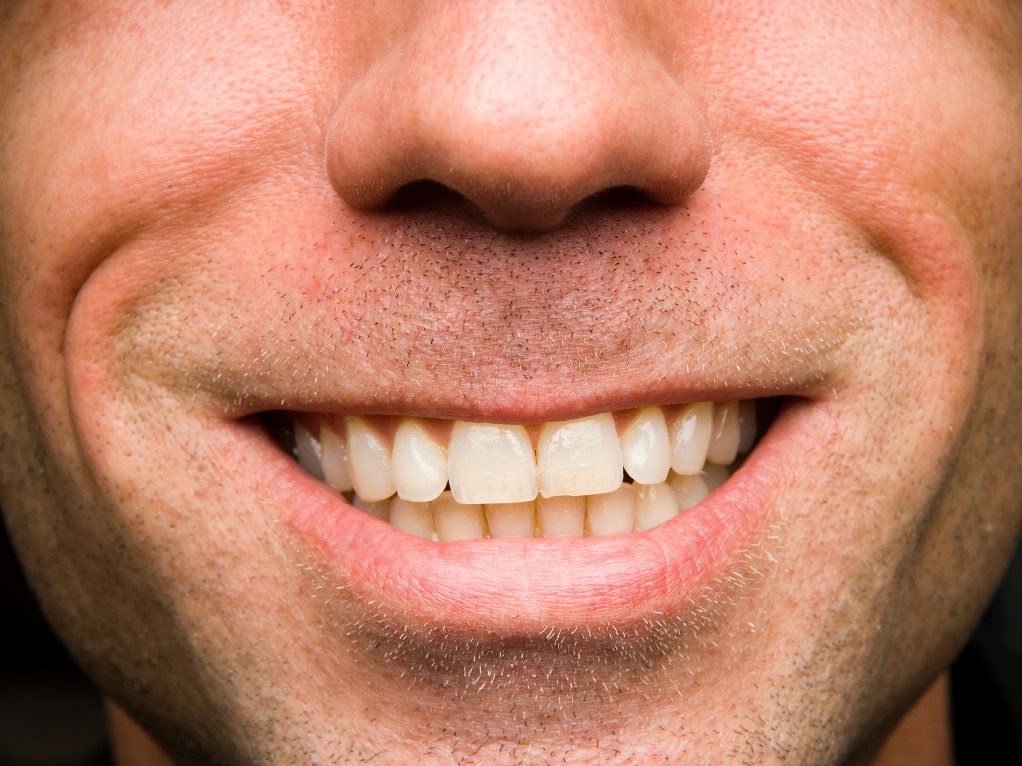Красивые мужские зубы фото