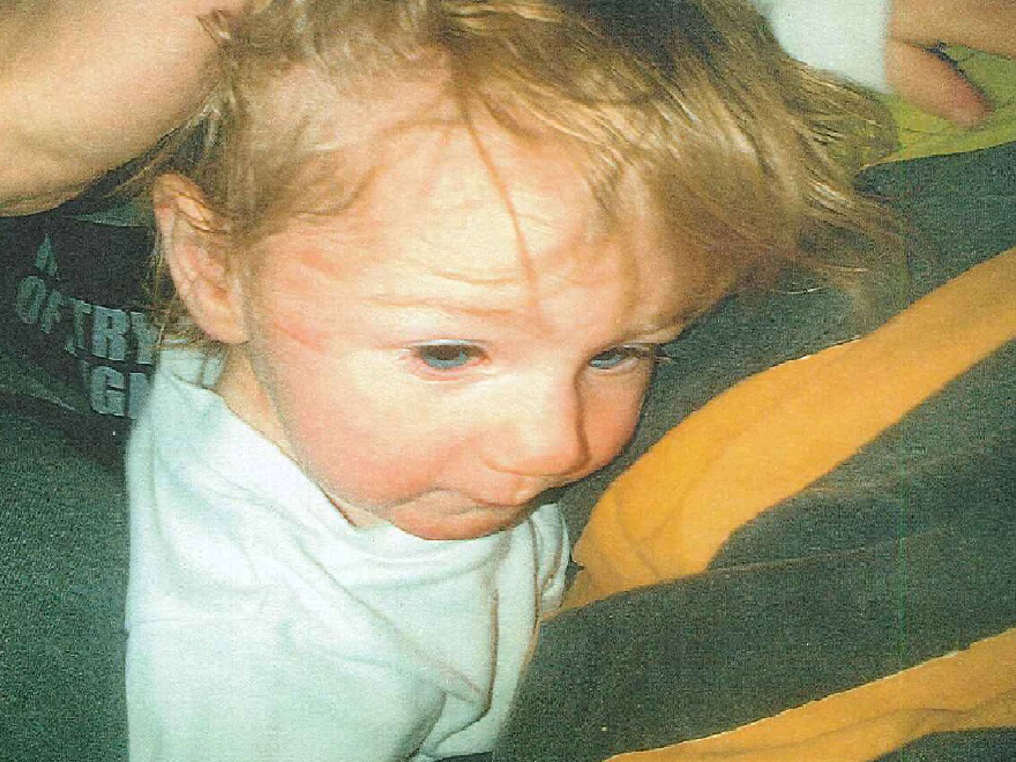Photo issued by Staffordshire Police of Ayeeshia Jane Smith before her death showing marks to her face and the underside of her chin