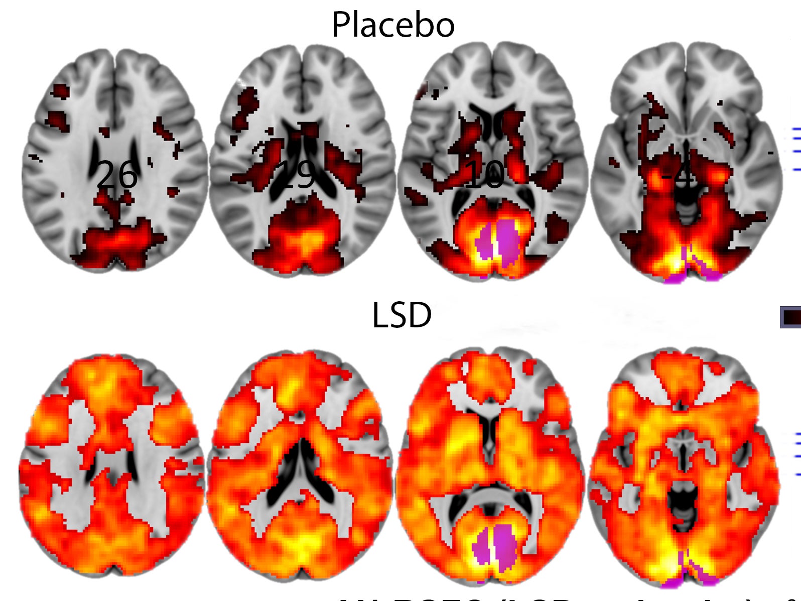 magic mushrooms effects on brain