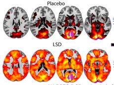 New study finds psychedelics can transform cancer patients' lives