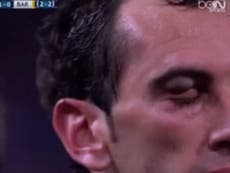 Luis Suarez elbow leaves Diego Godin's face a mess in Barcelona defeat by Atletico Madrid