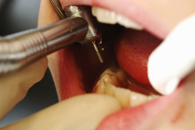The British Dental Association (BDA) has accused the Government of commissioning only enough dentistry to treat about half the adult population