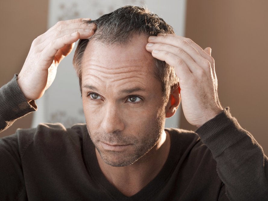 Balding In Men What Causes Male Pattern Baldness Dealing With It  Best  Hairstyles To Cover Balding