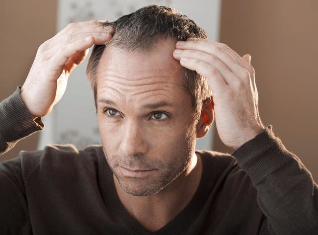 The only 4 things that can actually prevent hair loss | The Independent