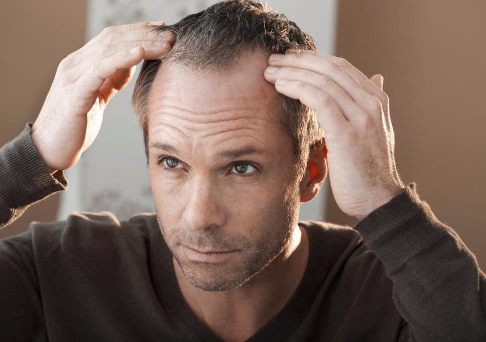 brylcreem and hair loss