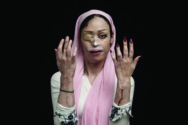 The 'Fired of Hatred' series won Asghar Khamseh the grand prize of $25,000