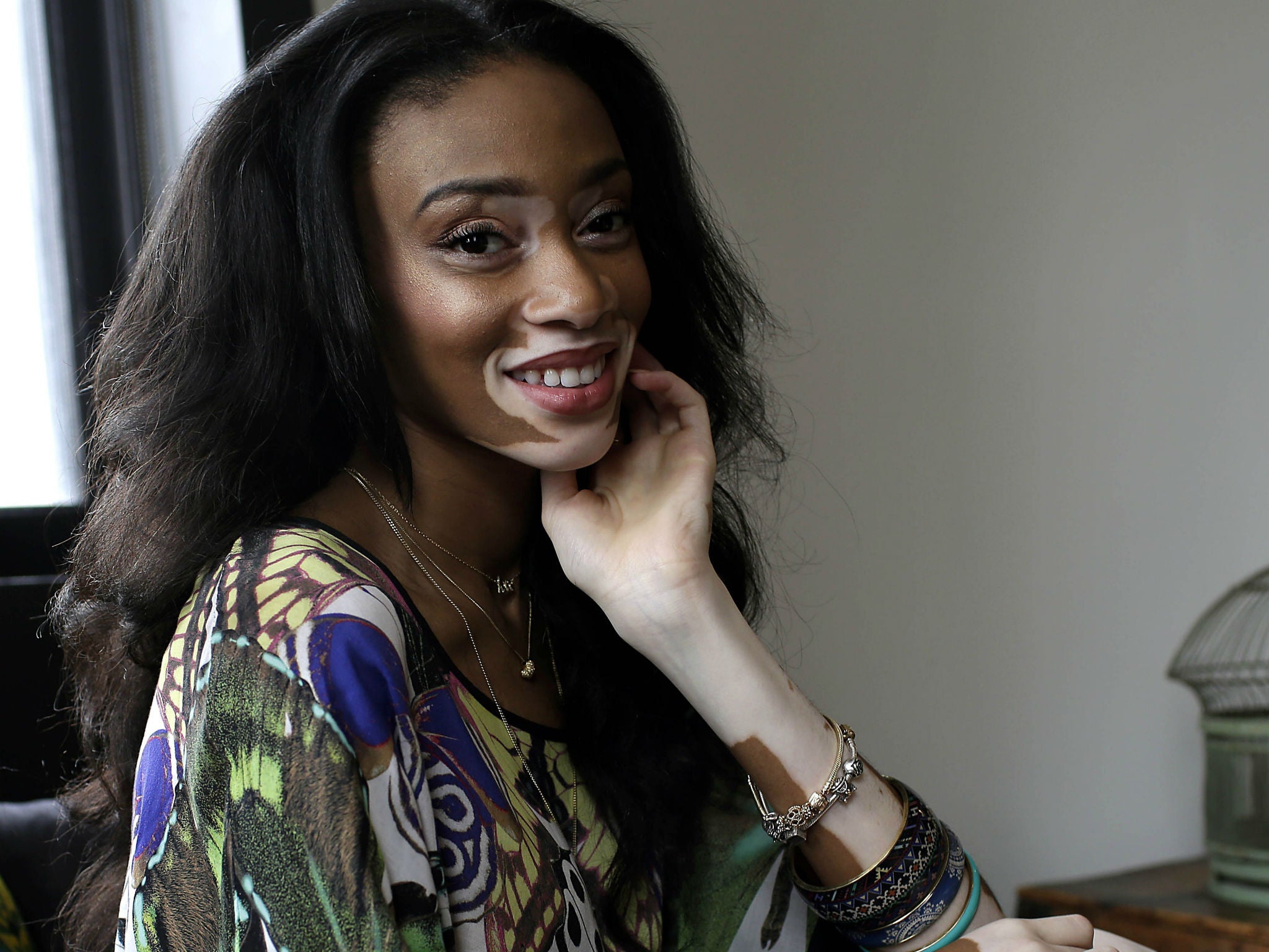 Winnie Harlow Everything you need to know about the star 