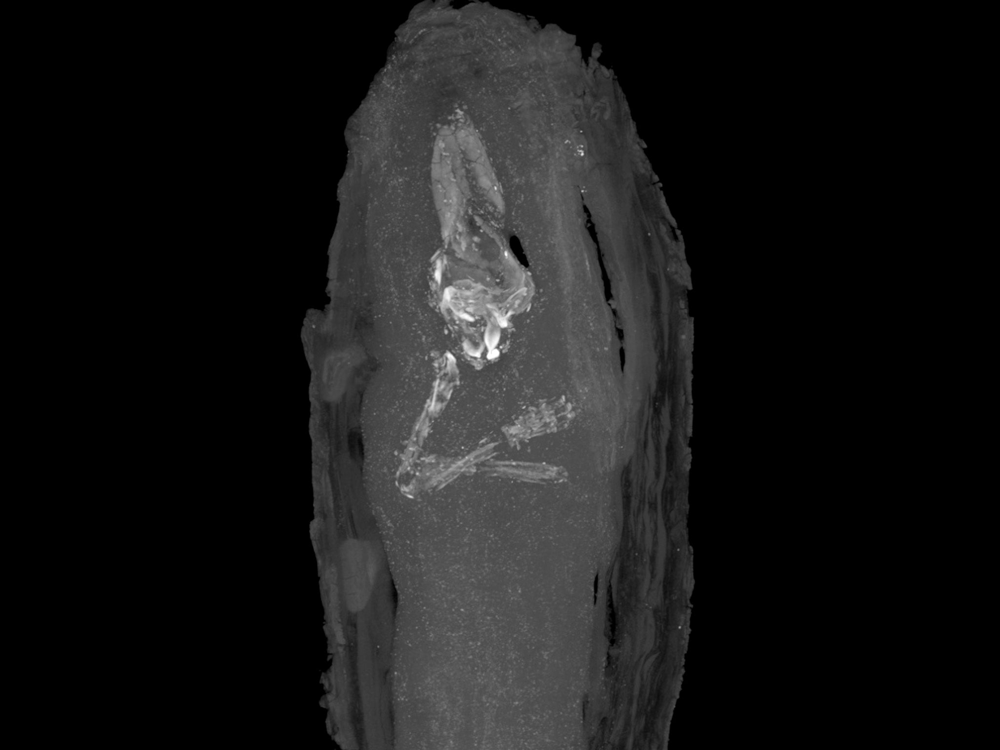 The coffin was scanned to reveal the tiny limbs of the unborn child