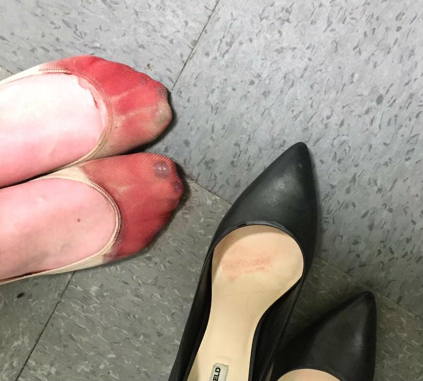 Waitress forced to wear high heels at work shares photo of her bleeding ...