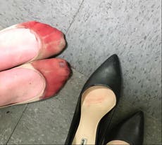Read more

Waitress forced to wear high heels at work shares photo of bloody feet