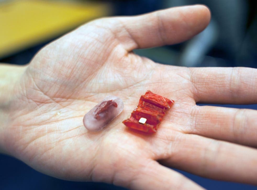 The robot is swallowed in pill form, and expands once inside the stomach