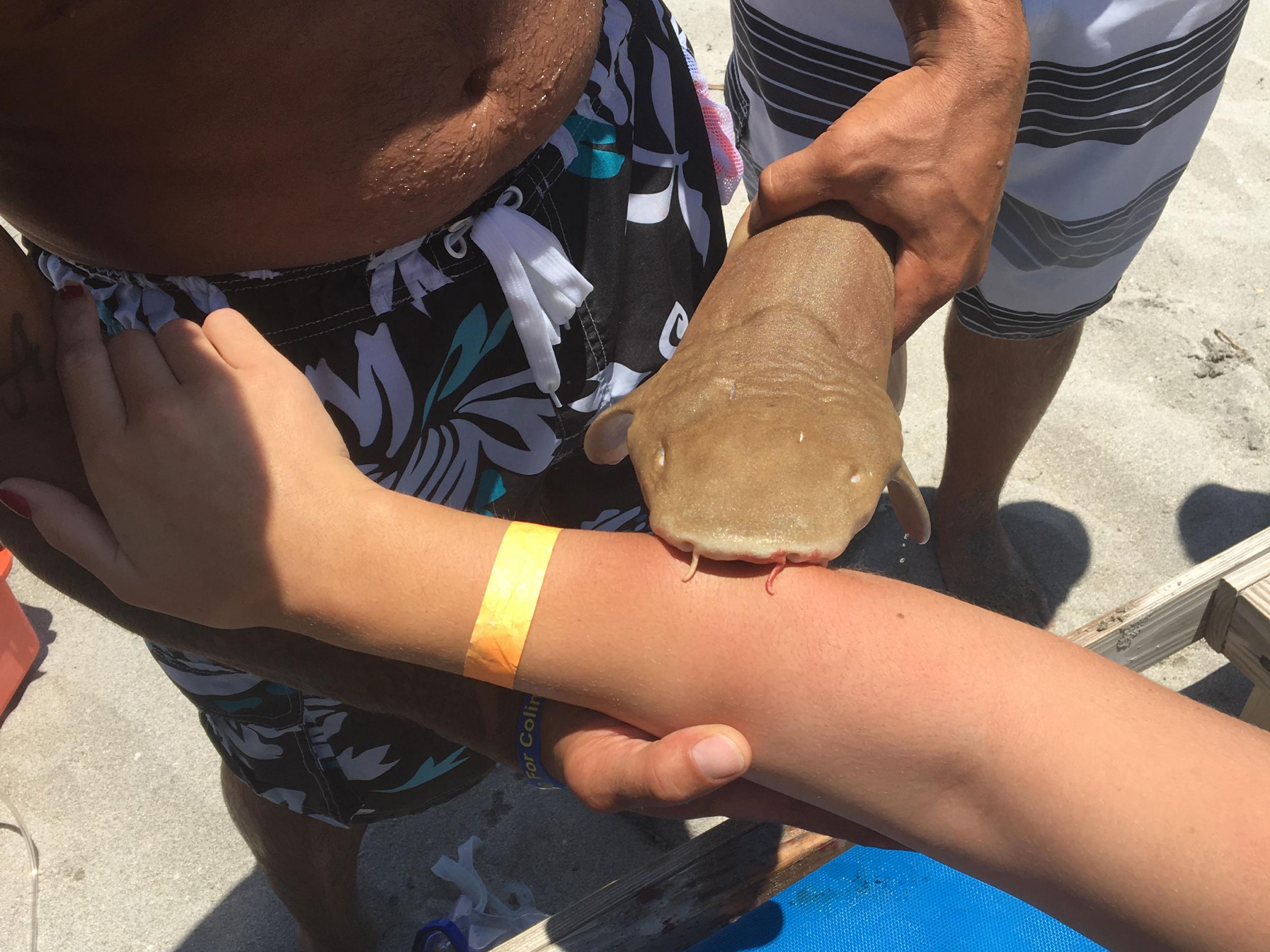 The shark would not let go of her arm, even after it died