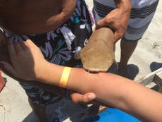 Woman taken to Florida hospital with shark still attached to her arm