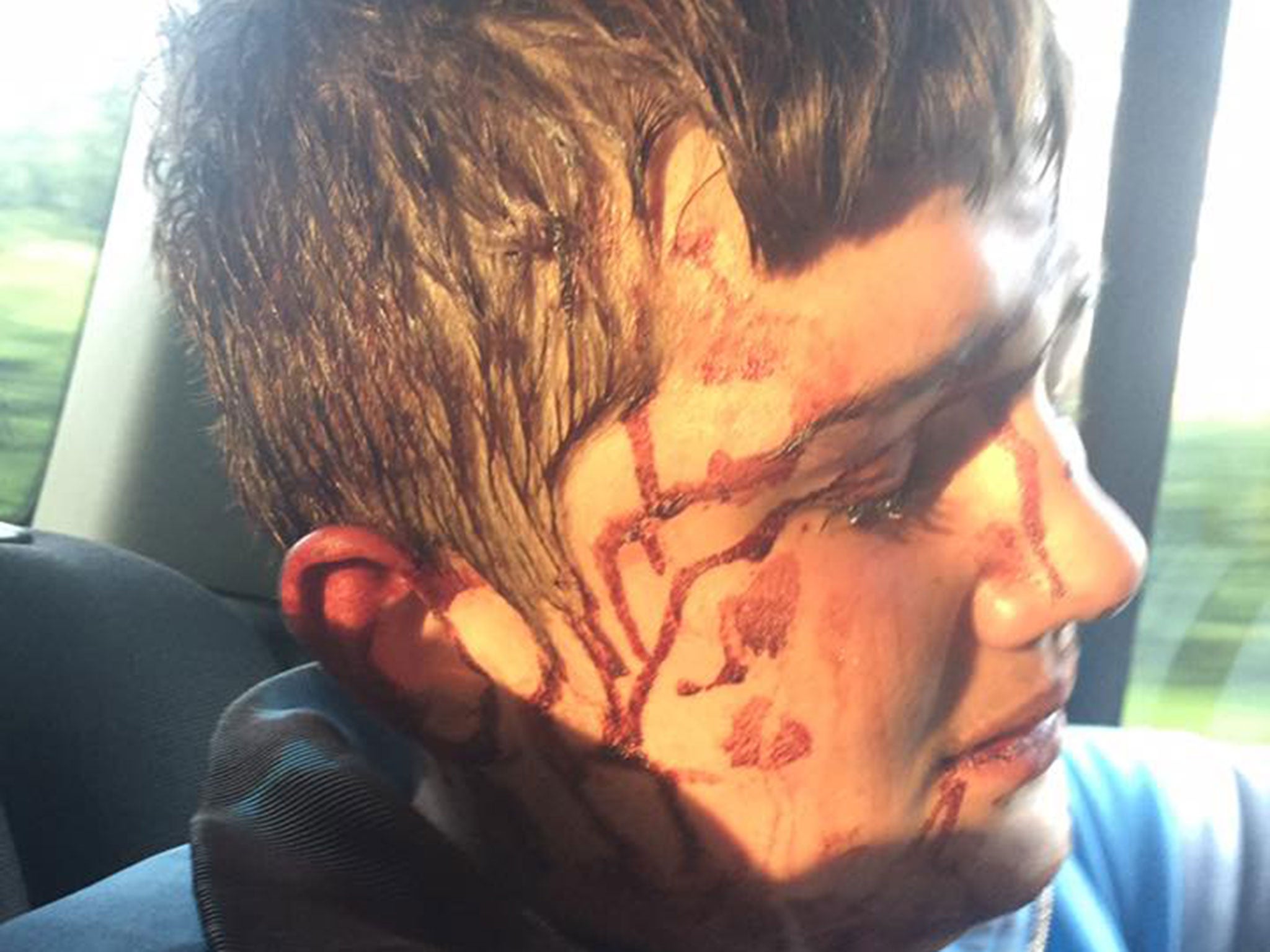 A picture shared by Harry Diamond's mother after he was allegedly attacked by eight men