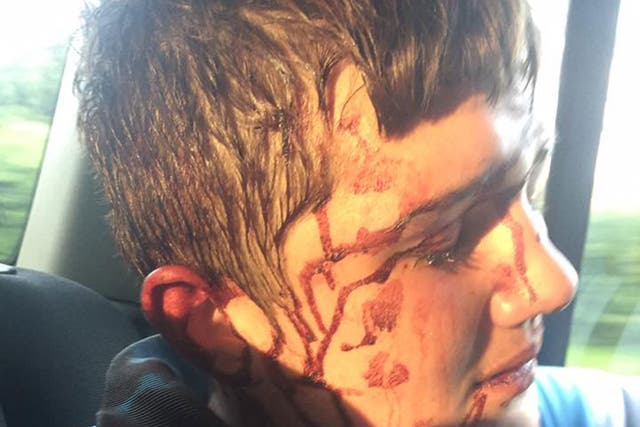 A picture shared by Harry Diamond's mother after he was allegedly attacked by eight men