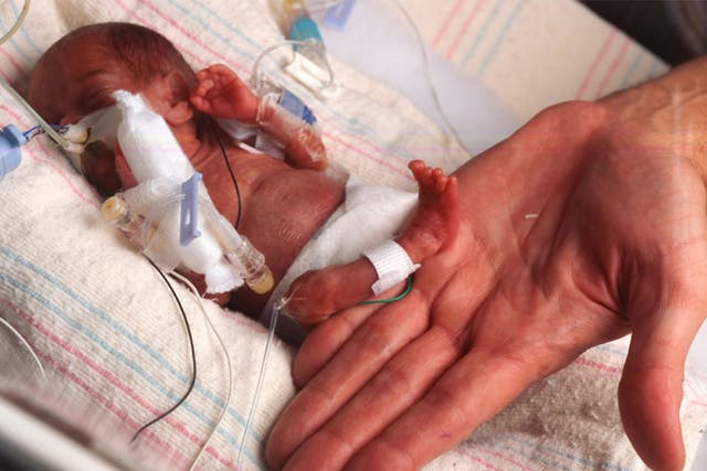 Rumaisa Rahman, the smallest known surviving baby, who was born at the weight of 8.6 ounces (243g) in September 2004