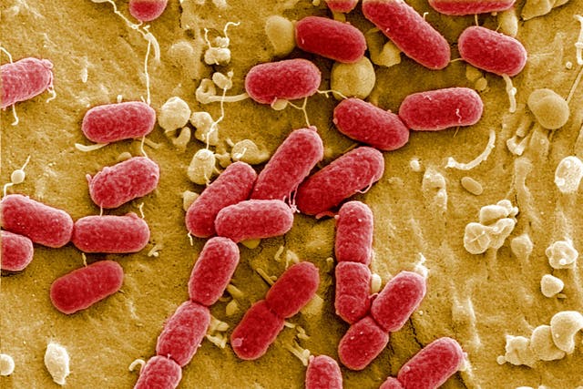 A posited superbug death toll of 10 million a year by 2050 was based on incomplete data, researchers say