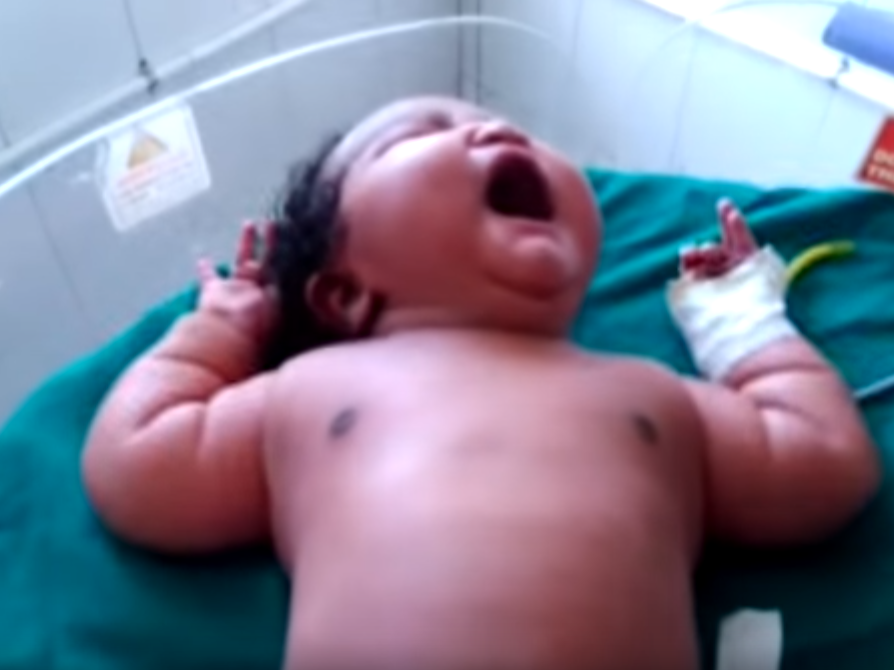 The baby girl weighing 15lb could be India's heaviest newborn ever