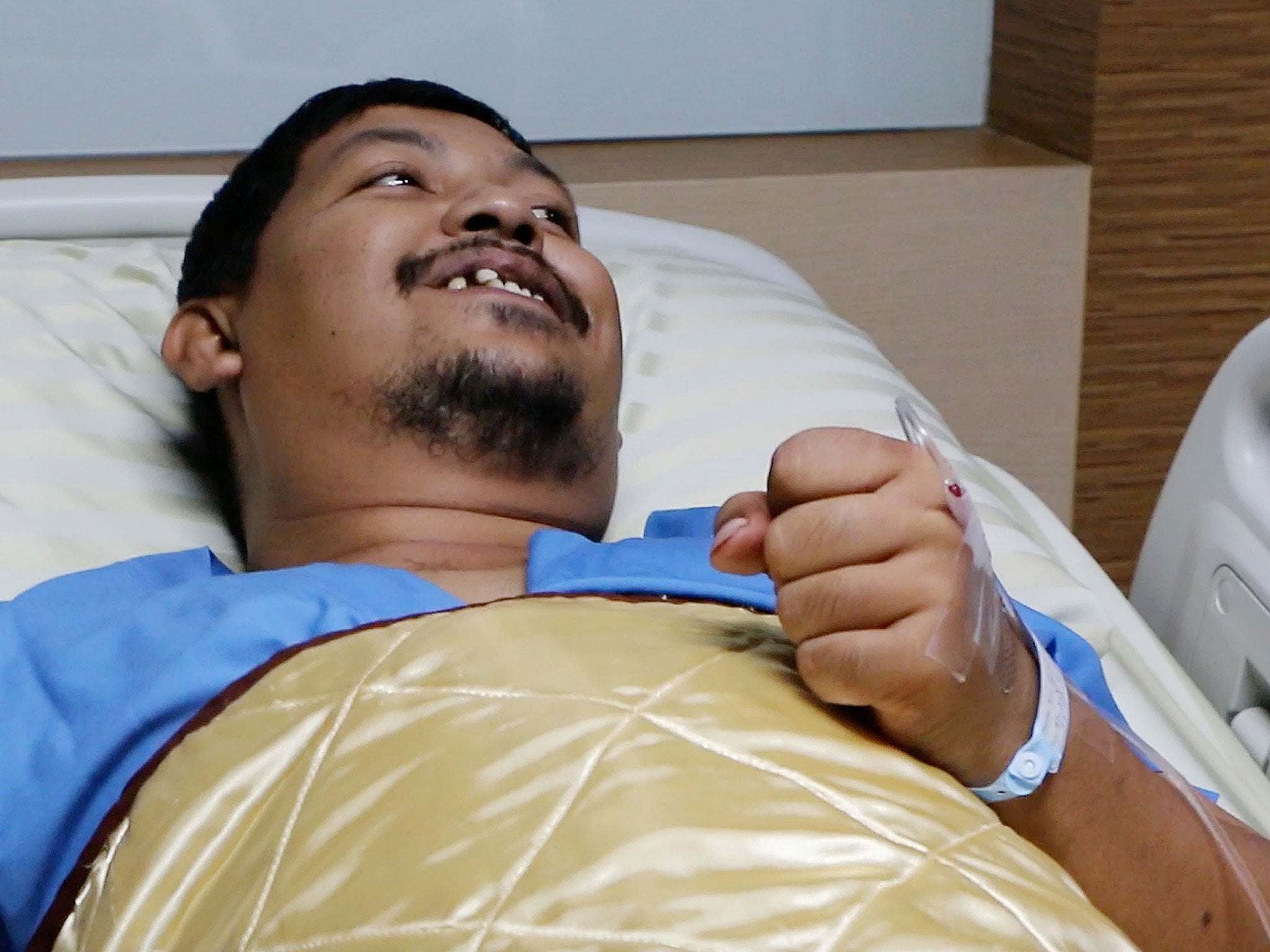Attaporn Boonmakchuay lays in a hospital bed following a snake attack at his home in Chachoengsao
