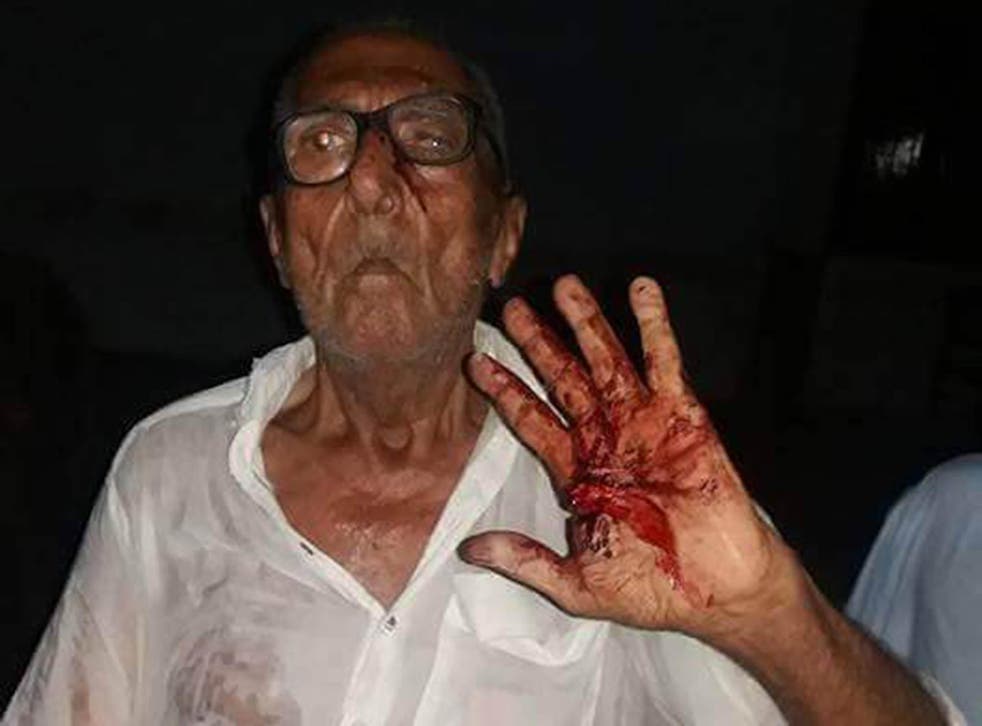 Gokal Das covered in blood after he was attacked for eating biryani