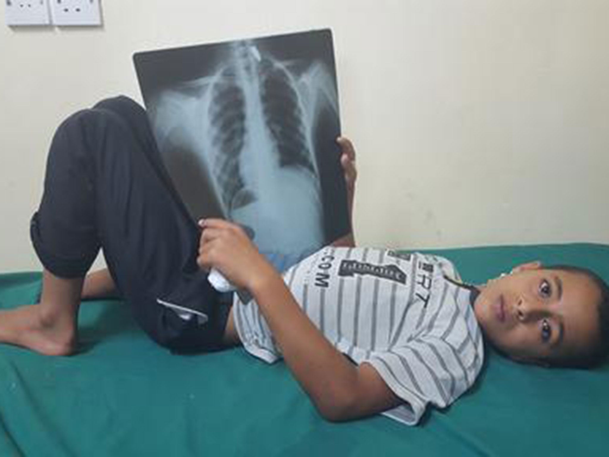 Ibrahim, 12, at an MSF hospital in Taiz, Yemen, after being shot in the neck as he left a mosque in April