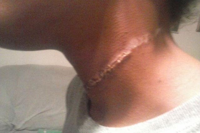 The girl suffered 'severe and painful' cuts on her neck from the rope
