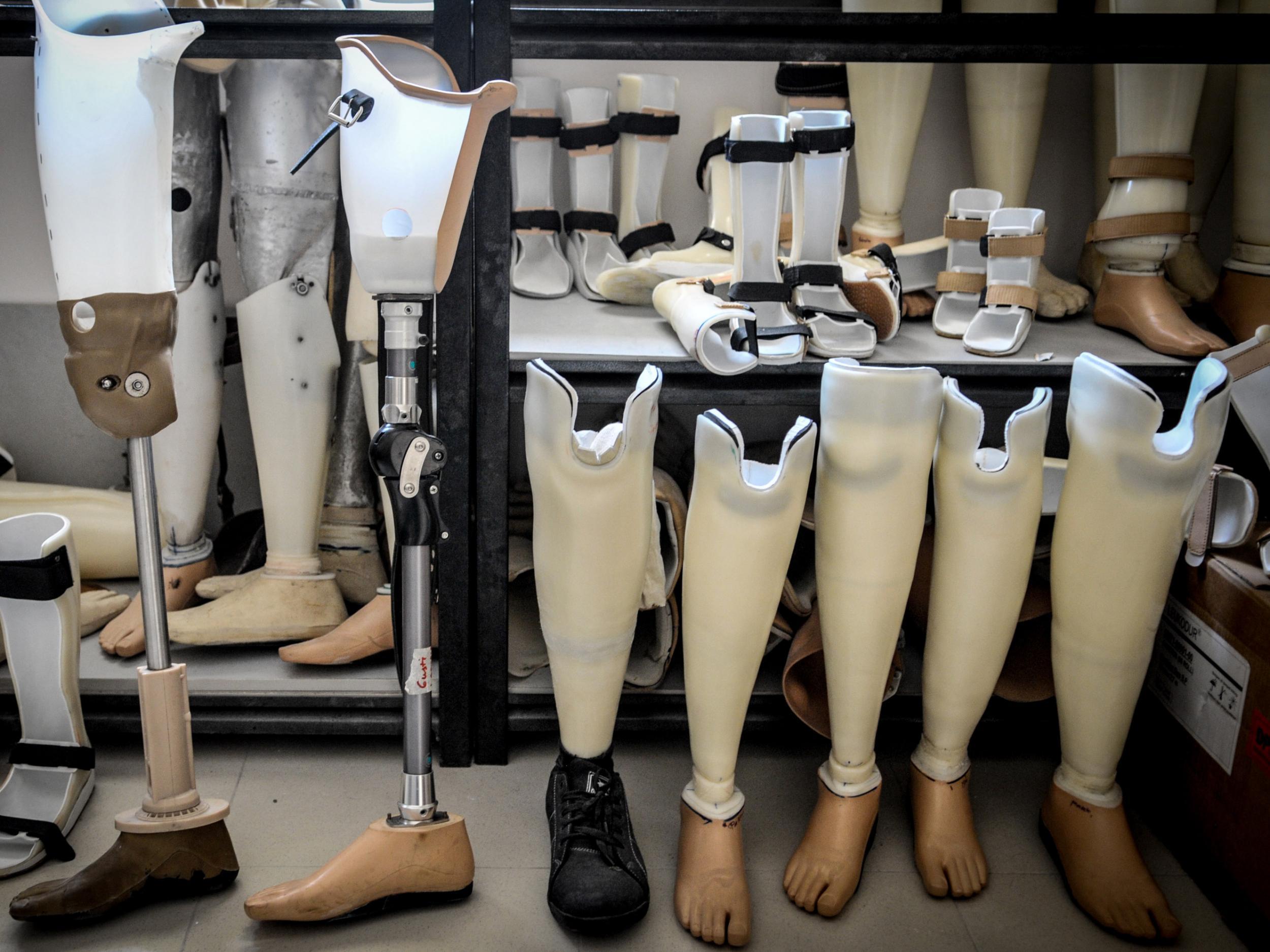 A collection of prosthetic limbs