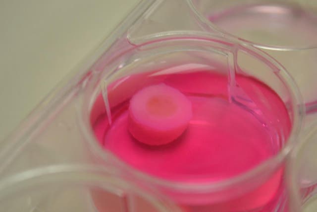 A plug of 3-D bioprinted cartilage on top of a plug of osteocondral material -- bone and cartilage. The bone sits in a bath of nutrient media