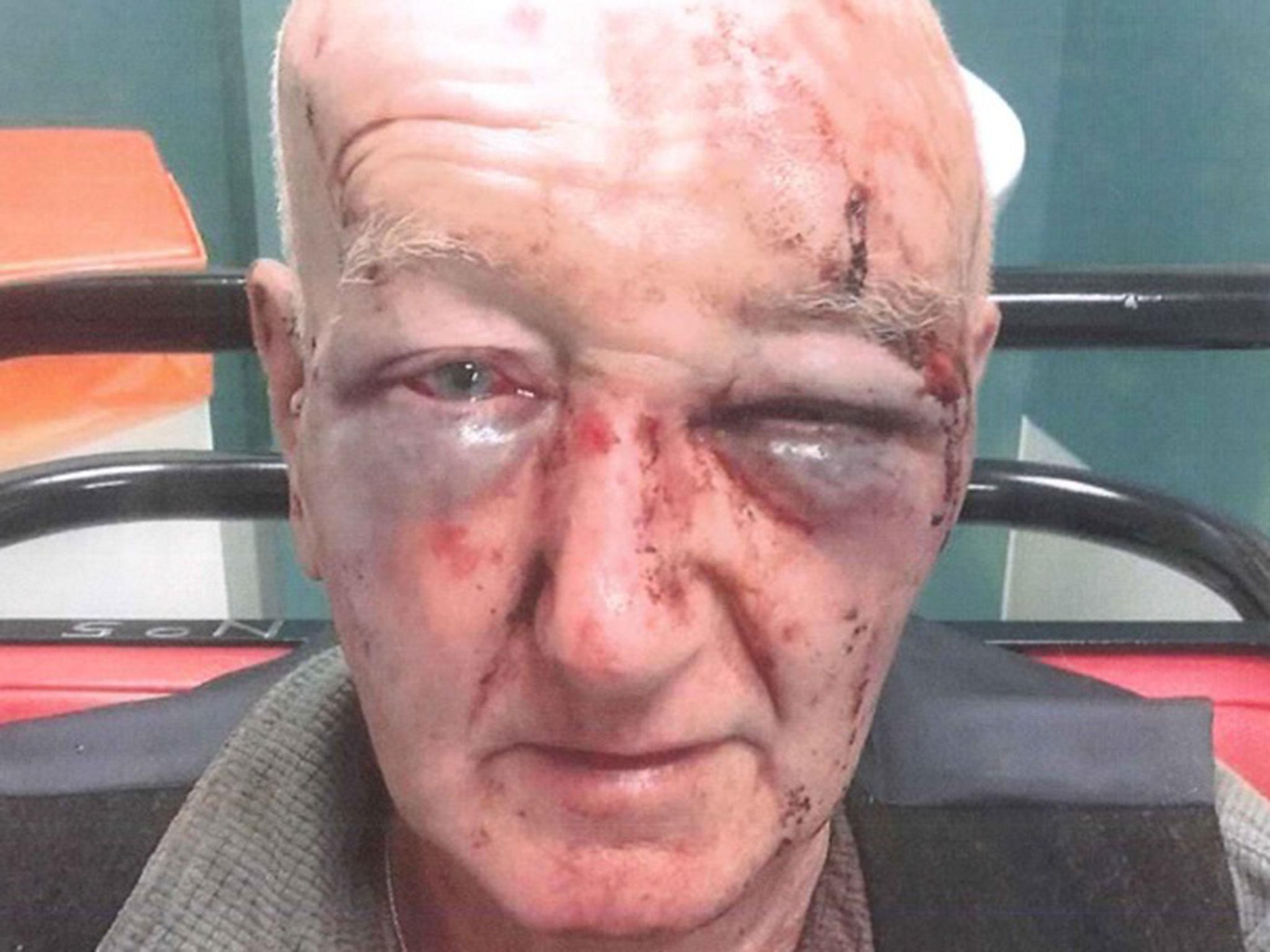 Police released an image of Derek Laidlow, 70, showing the severe bruising on his face in a bid for information to 'bring his attacker to justice'