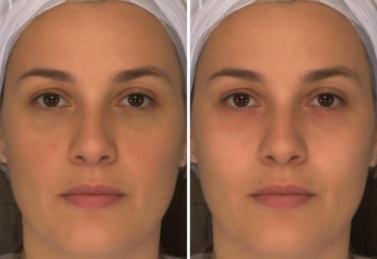 Red cheeks are healthy, red eyes not – do you think one looks healthier than the other?