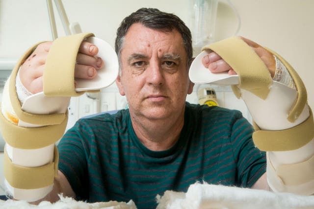 Britain's first double-hand transplant patient Chris King