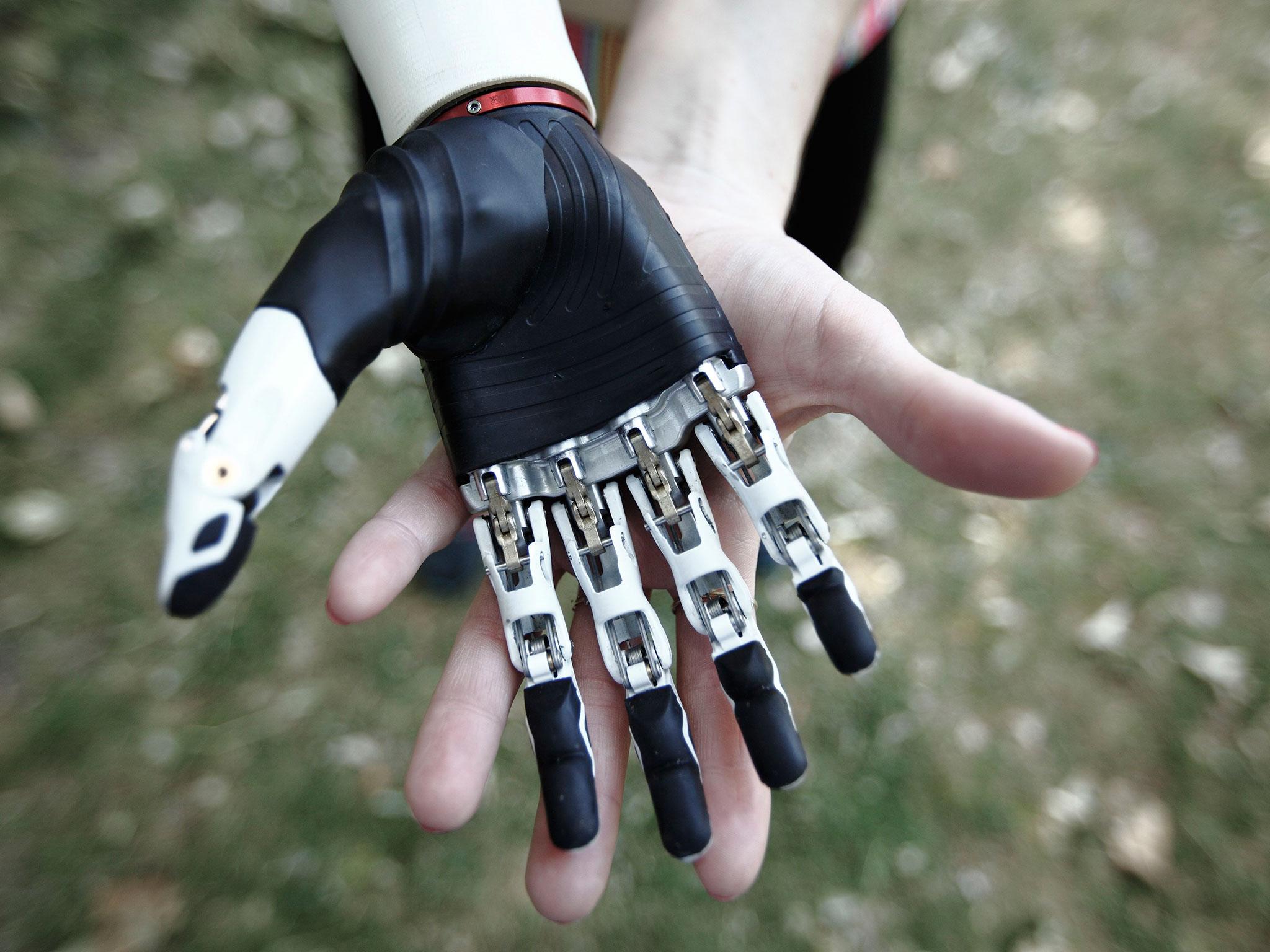 &#13;
Sensors in the bebionic arm allow it to move when the wearer contracts their muscles. &#13;