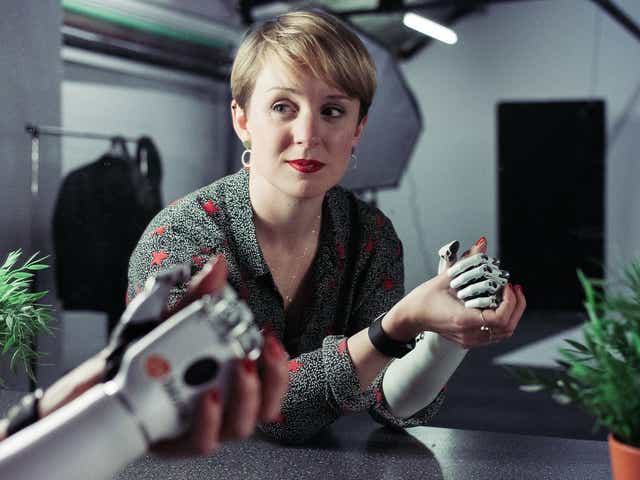 Nicky Ashwell was born without a right hand, and uses the bebionic arm designed by Steeper Steeper