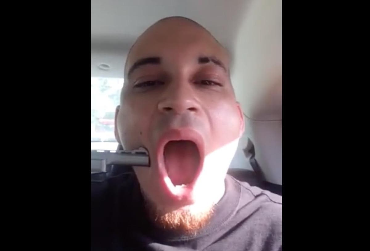 Rapper shoots a hole through his cheek to promote his music