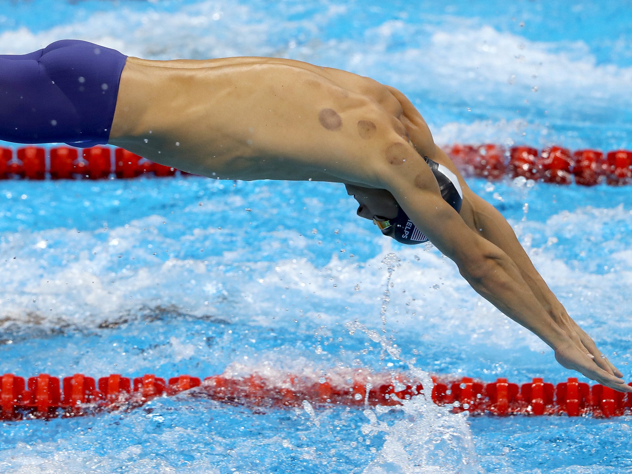 Michael Phelps at Rio - cupping marks can be seen on the athlete's shoulders as he competes in the final of the men's 4 x 100m freestyle relay on August 7 2016