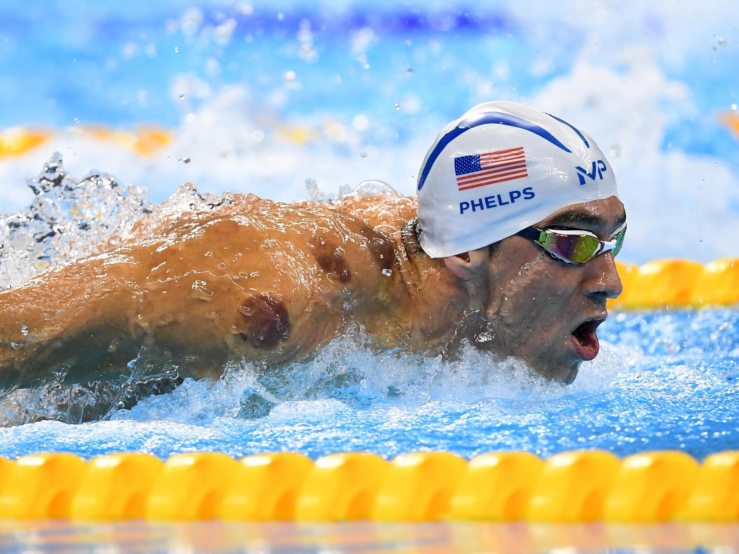 Since Michael Phelps seized his 19th gold medal on Sunday, interest in cupping has spiked