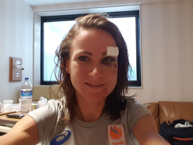 Van Vleuten revealed the extent of her facial injuries after the crash