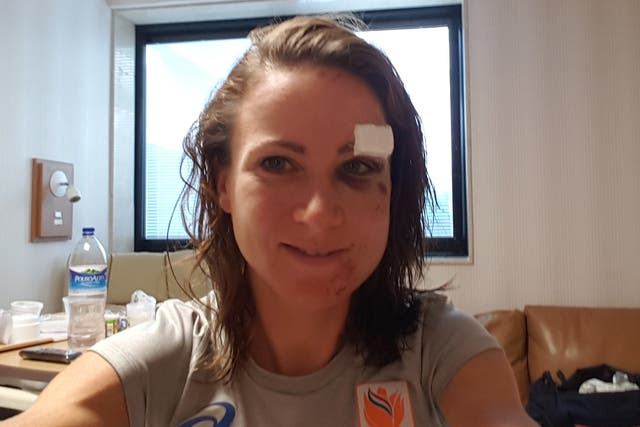 Van Vleuten revealed the extent of her facial injuries after the crash