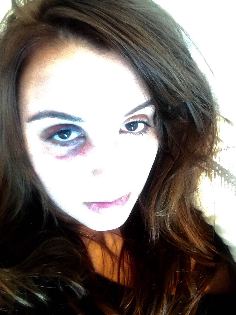 &#13;
Allison Smith, a 24-year-old former Sussex student, was punched and stamped on and had salt poured in her eyes and ears &#13;