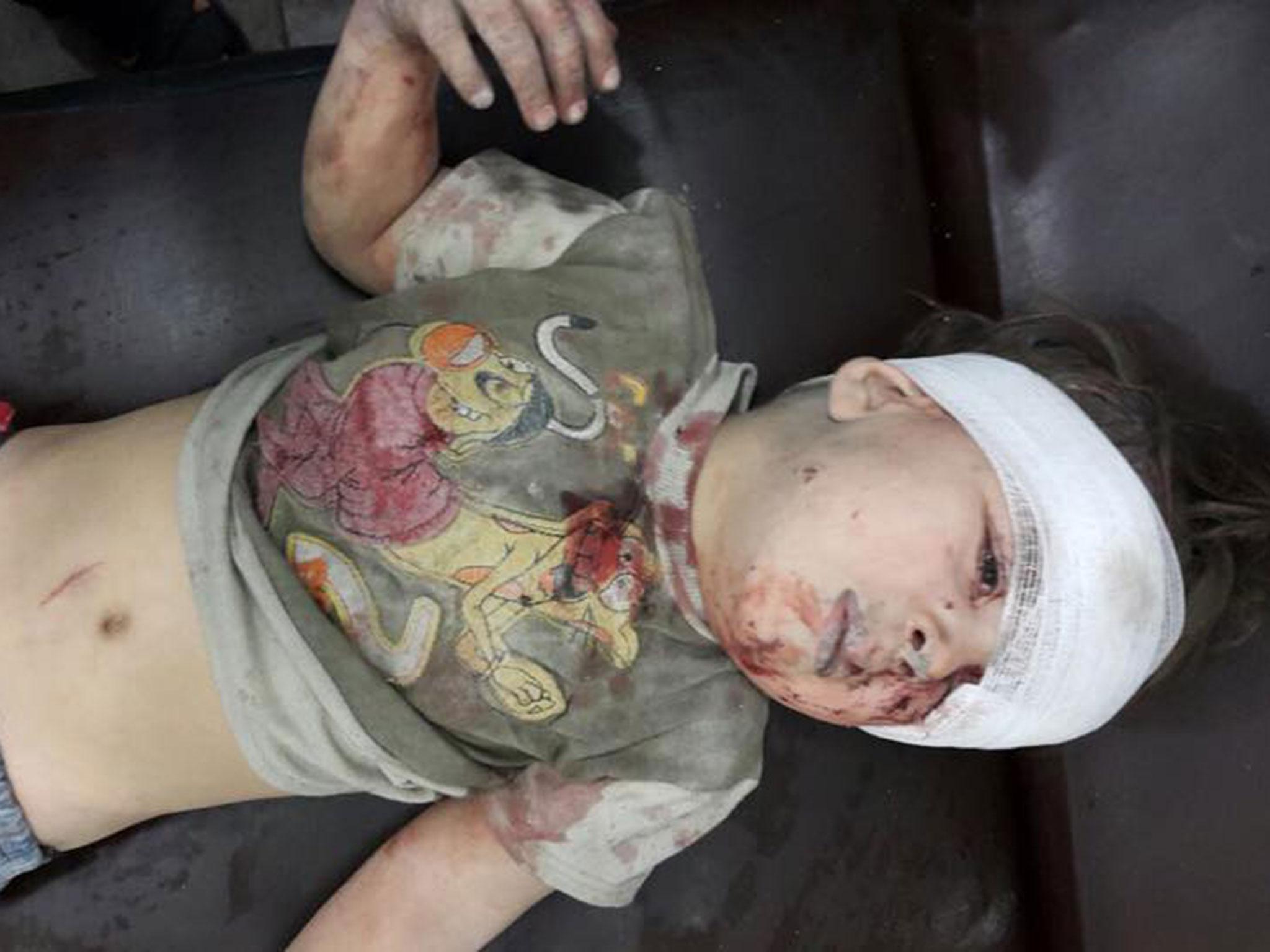 Omran Daqneesh after having received some medical treatment (Aleppo Media Centre )