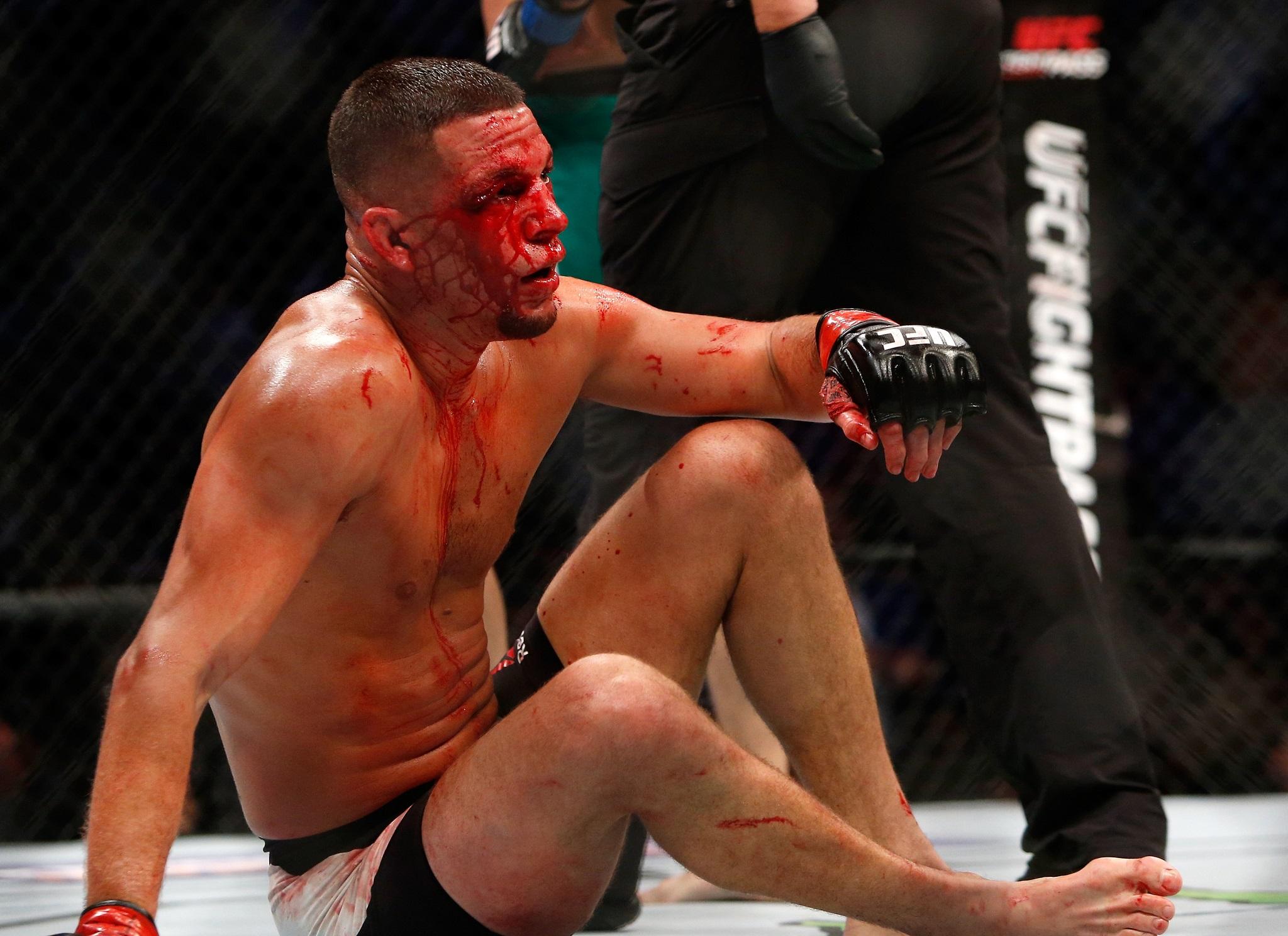 Diaz was left a bloodied mess after McGregor's barrage int he fourth (Getty)