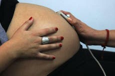 Texas has 'highest maternal mortality rate in developed world' 