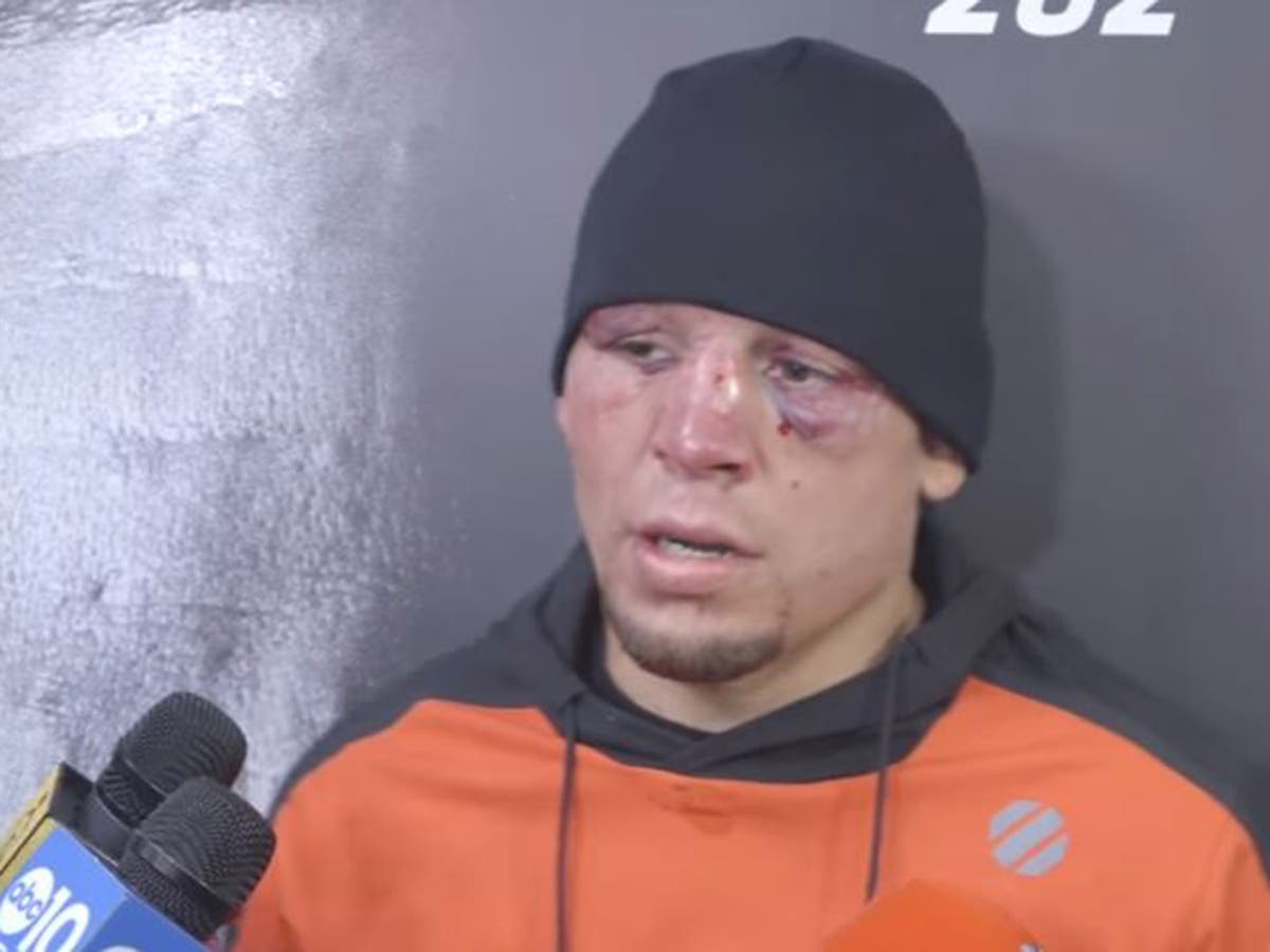 UFC 202: Nate Diaz reveals training injury before Conor ...