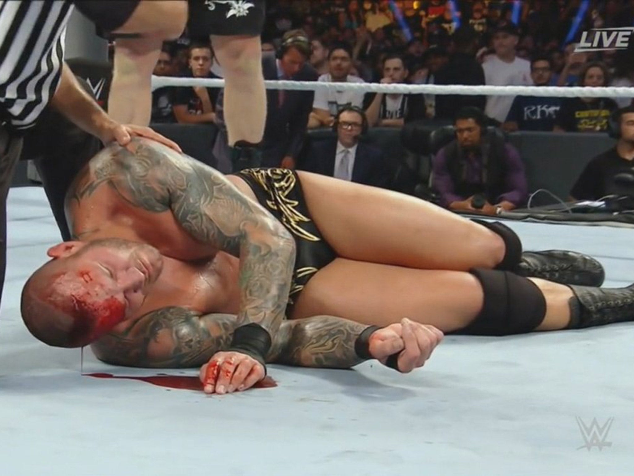Randy Orton was left with a large gash in his head
