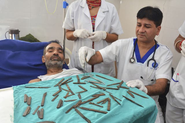 Jatinder Malhotra, right, displays the 40 knives that were surgically removed from the stomach of the police constable, as he recuperates in a hospital in Amritsar, India
