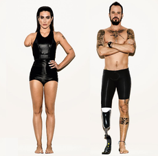 Vogue Brasil's digitally altered images sent the wrong message about disability