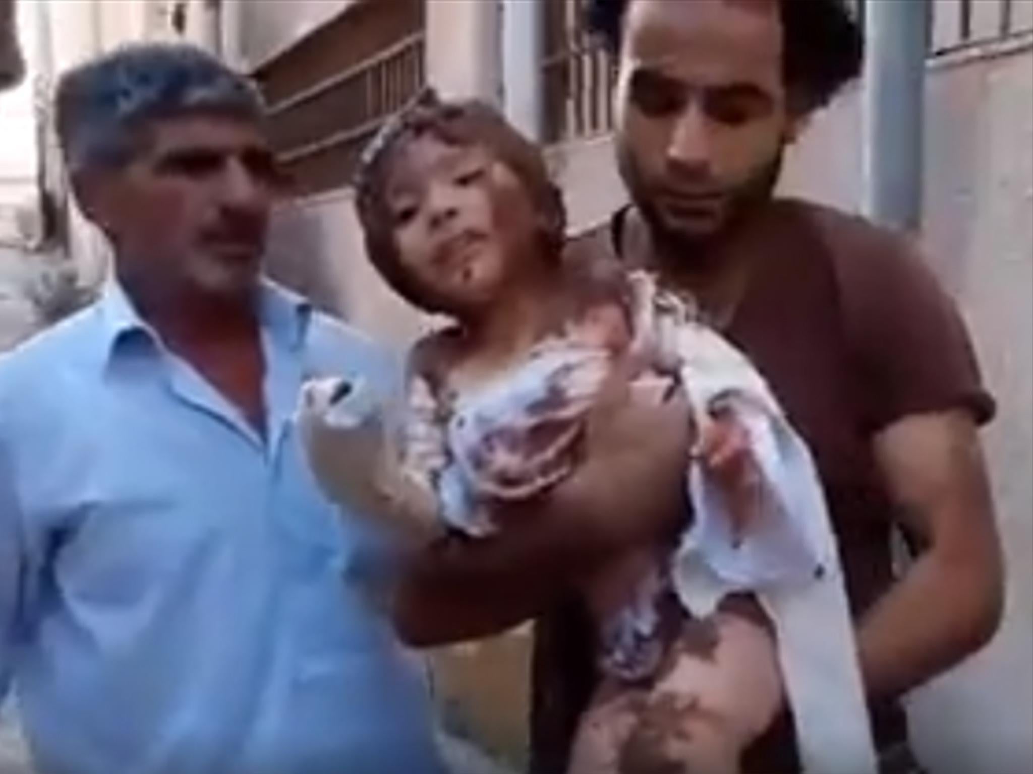 A Syrian child is smeared in mud because there is nothing else to put on her burns