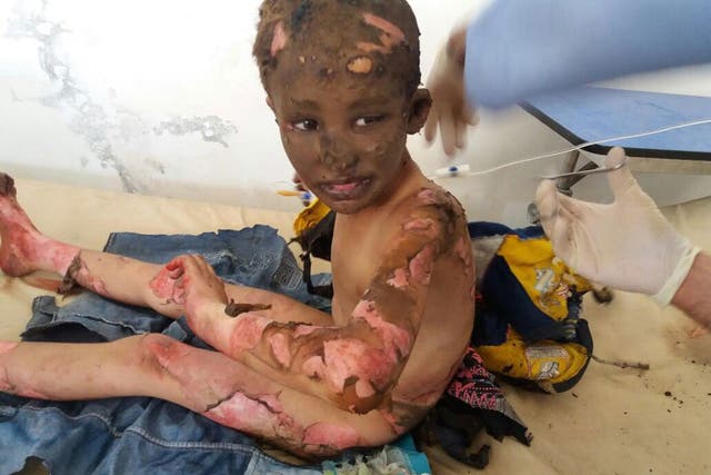 'This is not a victim of American Napalm in Vietnam but Syrian child victim of Assad's Napalm in Hama,' Dr Zaher Sahloul said