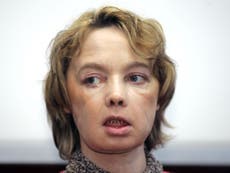 World's first face transplant recipient, Isabelle Dinoire, dies aged 49 in France