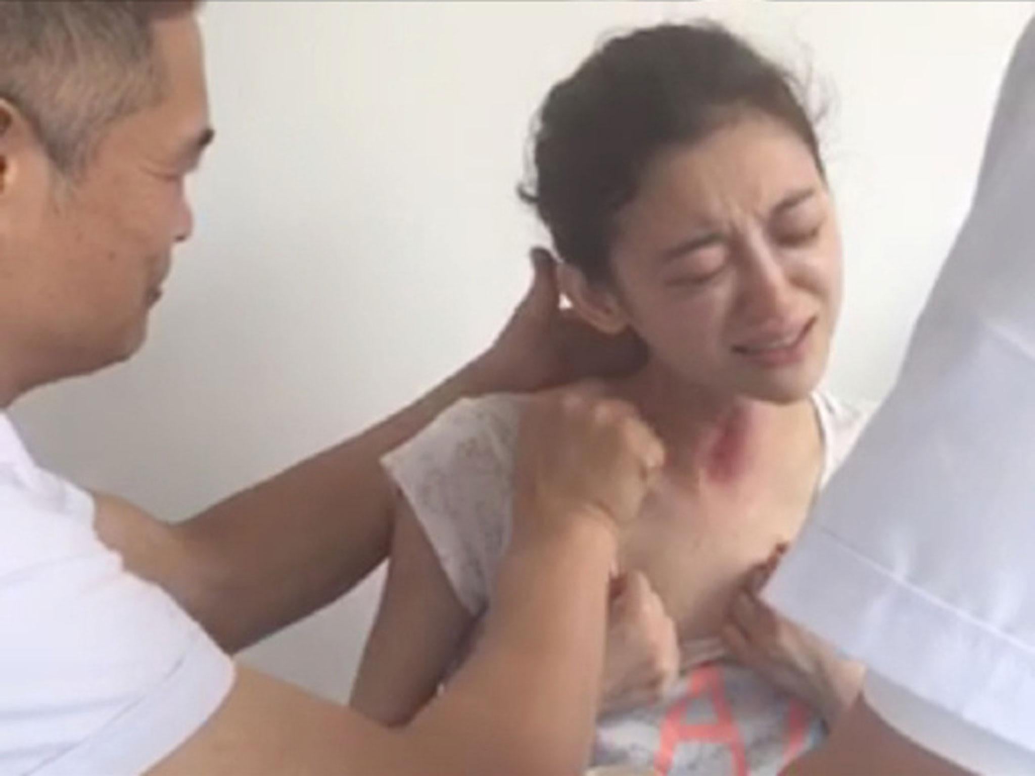 Other images show her undergoing gua sha skin scraping therapy